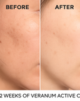 Veranum Active C Vitamin C Ampoule Brightening · Skin-Strengthening 25% Vitamin C Serum